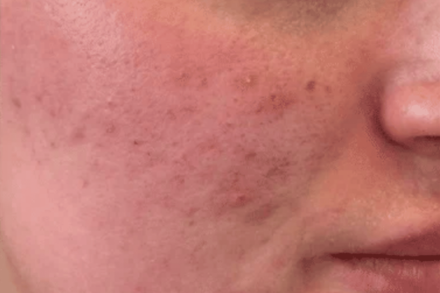 Sea Powder after treatment