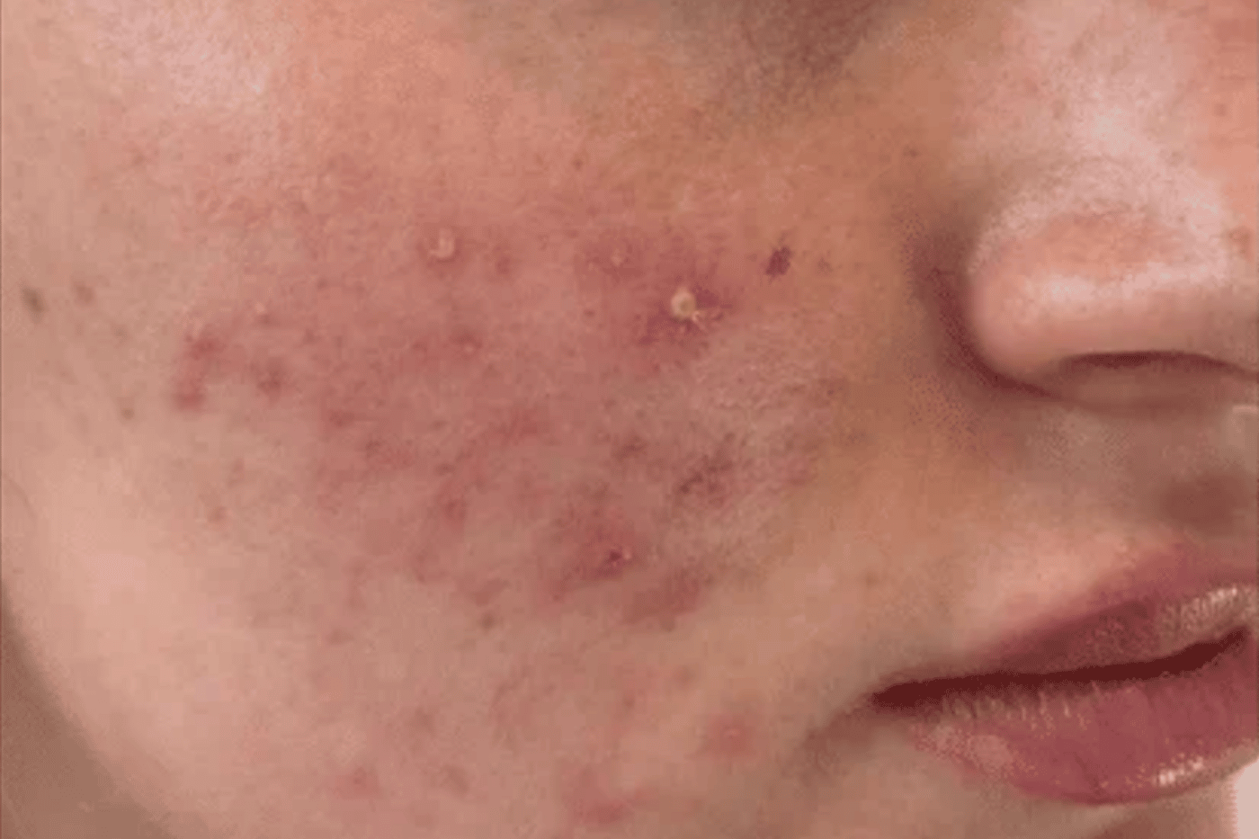 Sea Powder before treatment